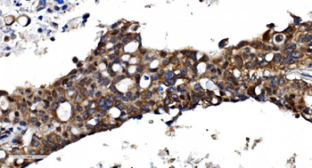 TBP-1/PSMC3/TBP Rabbit Polyclonal Antibody