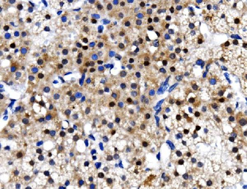 TBP-1/PSMC3/TBP Rabbit Polyclonal Antibody