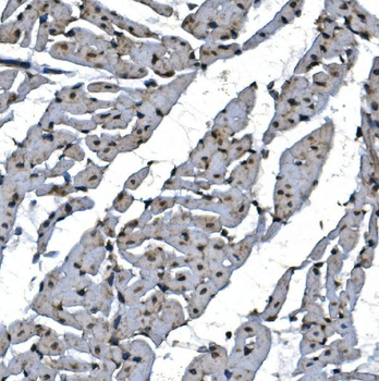 TBP-1/PSMC3/TBP Rabbit Polyclonal Antibody