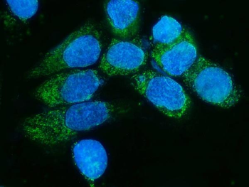 TIMM8A/DDP Rabbit Polyclonal Antibody