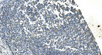 TIMM8A/DDP Rabbit Polyclonal Antibody
