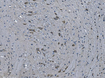 TMPRSS3 Rabbit Polyclonal Antibody