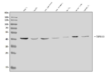 TMPRSS3 Rabbit Polyclonal Antibody