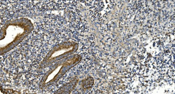 NOX2/gp91phox/CYBB Rabbit Polyclonal Antibody