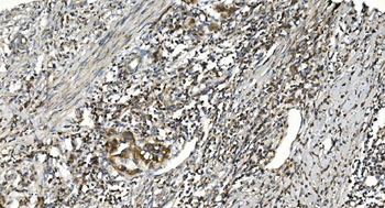NOX2/gp91phox/CYBB Rabbit Polyclonal Antibody