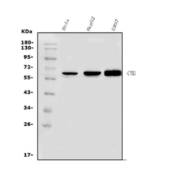 NOX2/gp91phox/CYBB Rabbit Polyclonal Antibody