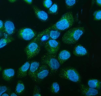 DNAJC10 Rabbit Polyclonal Antibody
