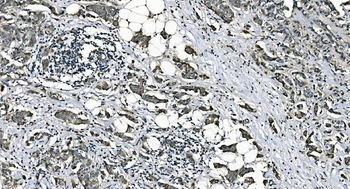 DNAJC10 Rabbit Polyclonal Antibody