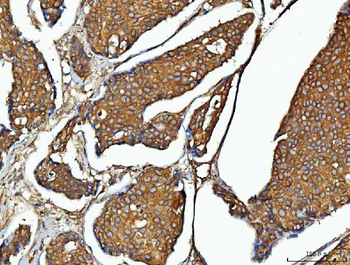 EEF2 Rabbit Polyclonal Antibody