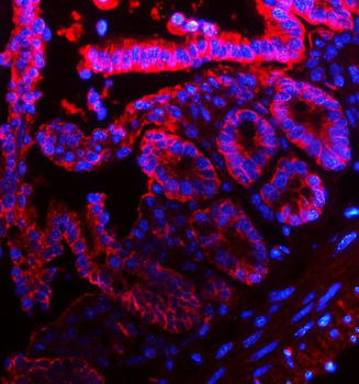 EpCAM Rabbit Polyclonal Antibody