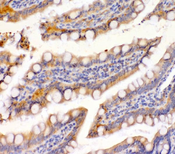 EpCAM Rabbit Polyclonal Antibody
