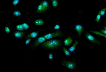 FEZF1 Rabbit Polyclonal Antibody