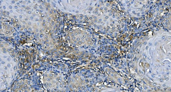 GABARAP Rabbit Polyclonal Antibody