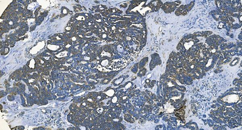 GABARAP Rabbit Polyclonal Antibody
