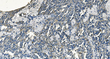GABARAP Rabbit Polyclonal Antibody