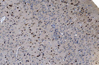 GABARAP Rabbit Polyclonal Antibody
