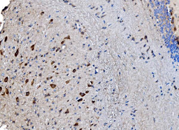 GABARAP Rabbit Polyclonal Antibody