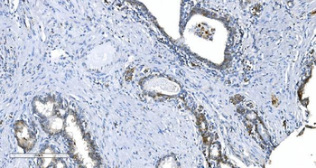 GCHFR Rabbit Polyclonal Antibody