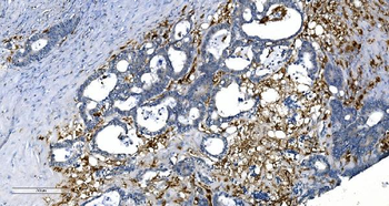 GCHFR Rabbit Polyclonal Antibody