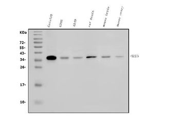 HOXC8 Rabbit Polyclonal Antibody