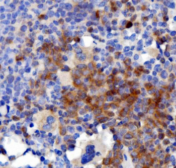 IL3 Rabbit Polyclonal Antibody