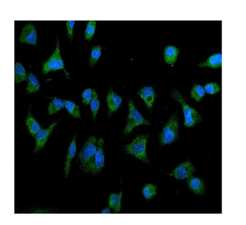 IL2 Receptor beta/p75/IL2RB Rabbit Polyclonal Antibody