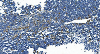 IL2 Receptor beta/p75/IL2RB Rabbit Polyclonal Antibody
