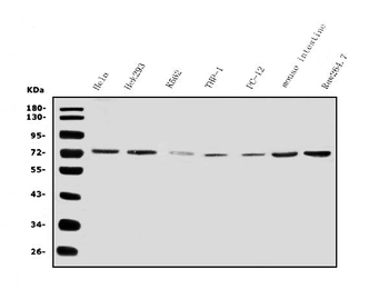 IL2 Receptor beta/p75/IL2RB Rabbit Polyclonal Antibody