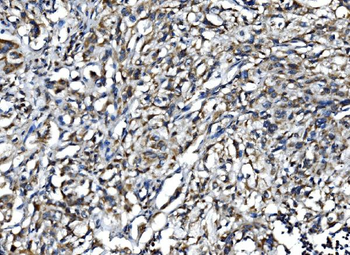 IL15 Rabbit Polyclonal Antibody