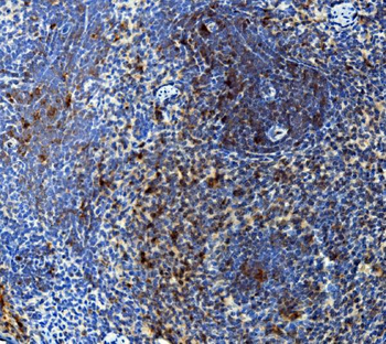 IL15 Rabbit Polyclonal Antibody