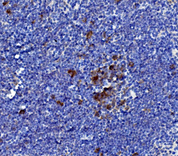 IL-21/Il21/IL Rabbit Polyclonal Antibody