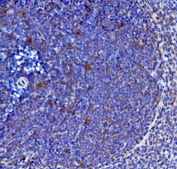 IL-21/Il21/IL Rabbit Polyclonal Antibody