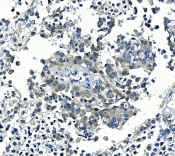 Kir6.1/KCNJ8 Rabbit Polyclonal Antibody