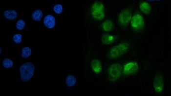 METTL3 Rabbit Polyclonal Antibody