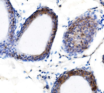 METTL3 Rabbit Polyclonal Antibody