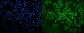 LXR beta/NER/NR1H2 Rabbit Polyclonal Antibody