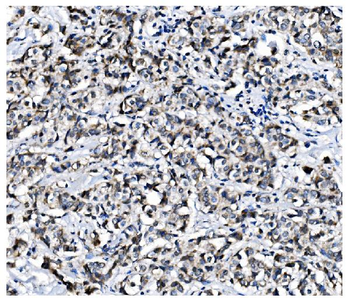 PCBP1 Rabbit Polyclonal Antibody