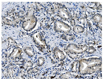 PCBP1 Rabbit Polyclonal Antibody