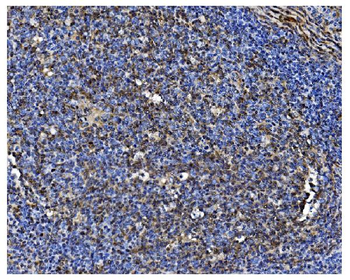 PCBP1 Rabbit Polyclonal Antibody