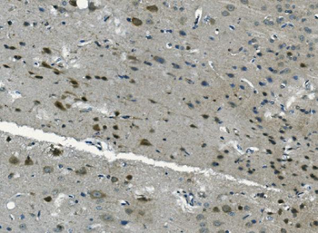 PCBP2/hnRNP E2 Rabbit Polyclonal Antibody