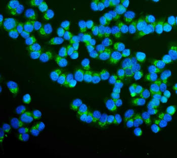 RAB1B Rabbit Polyclonal Antibody