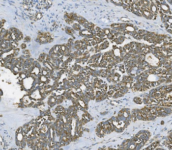 RAB1B Rabbit Polyclonal Antibody