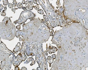 RAB1B Rabbit Polyclonal Antibody