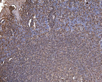 RAB1B Rabbit Polyclonal Antibody