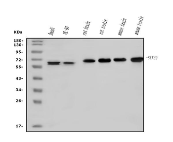 SPAK/STK39 Rabbit Polyclonal Antibody
