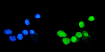 Sumo 1/SUMO1 Rabbit Polyclonal Antibody