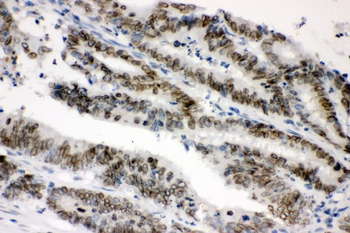 Sumo 1/SUMO1 Rabbit Polyclonal Antibody