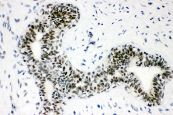Sumo 1/SUMO1 Rabbit Polyclonal Antibody