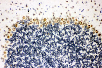 Sumo 1/SUMO1 Rabbit Polyclonal Antibody