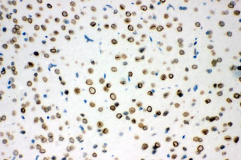 Sumo 1/SUMO1 Rabbit Polyclonal Antibody